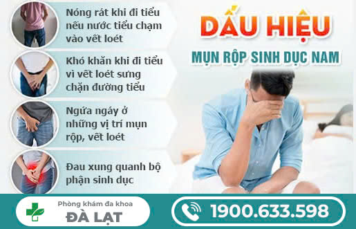 Hình ảnh minh họa